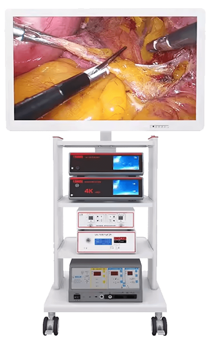 3D Laparoscopy